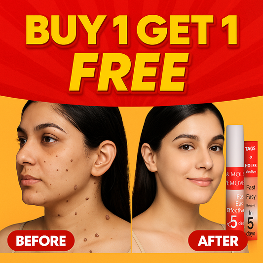 Tags & Moles Remover - Buy 1 Get 1 FREE