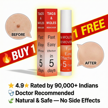 Tags & Moles Remover - Buy 1 Get 1 FREE